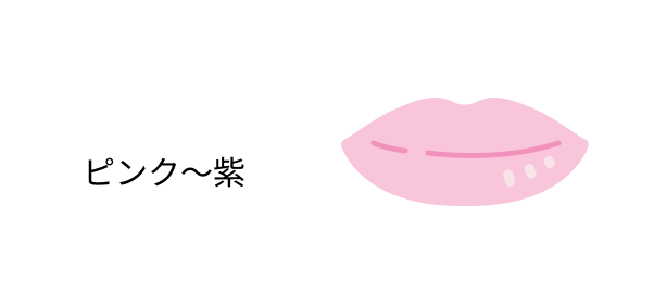 ピンク～紫